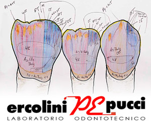 LABORATORIO ODONTOTECNICO ERCOLINI E PUCCI